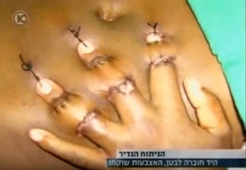 סיפורה של א